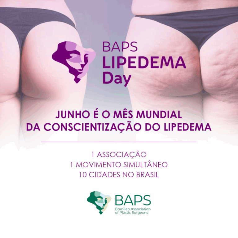 baps-lipedema-day